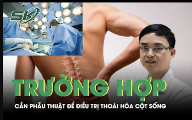 Trường hợp nào cần phẫu thuật để điều trị thoái hóa cột sống