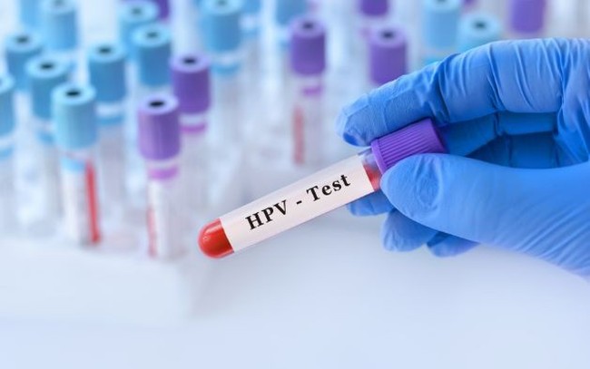 Xét nghiệm HPV dương tính có mắc ung thư cổ tử cung?