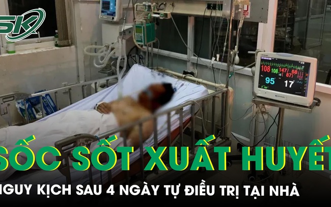 Người đàn ông nguy kịch sốc sốt xuất huyết nặng sau 4 ngày tự điều trị tại nhà