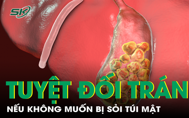 Tuyệt đối tránh điều này nếu không muốn bị sỏi túi mật