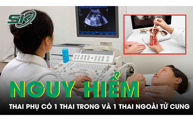 Cứu thai phụ có 1 thai trong và 1 thai ngoài tử cung