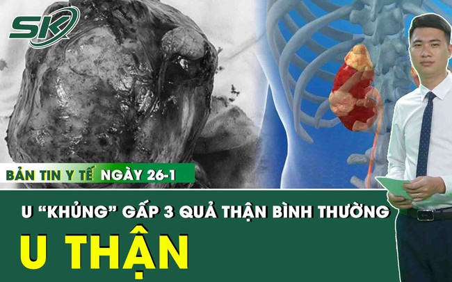 Tổng hợp những thông tin y tế nóng nhất trong ngày 26/1