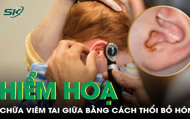 Hiểm hoạ khi chữa viêm tai giữa bằng cách thổi bồ hóng, bột đá