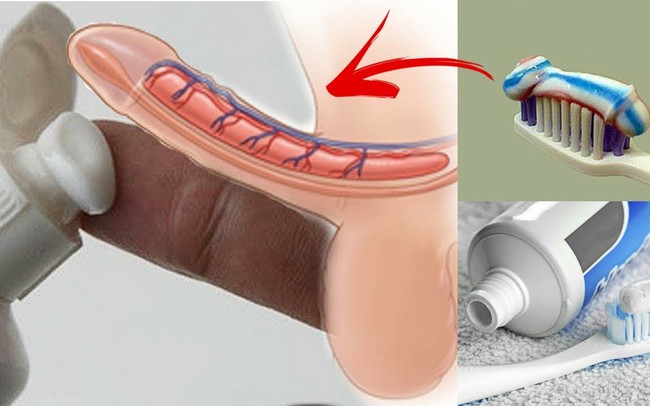 Bôi kem đánh răng chống xuất tinh sớm có hiệu quả không?