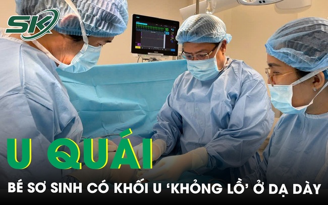 Bé trai sơ sinh đầu tiên tại Việt Nam có khối u quái 'khổng lồ' ở dạ dày hiếm gặp