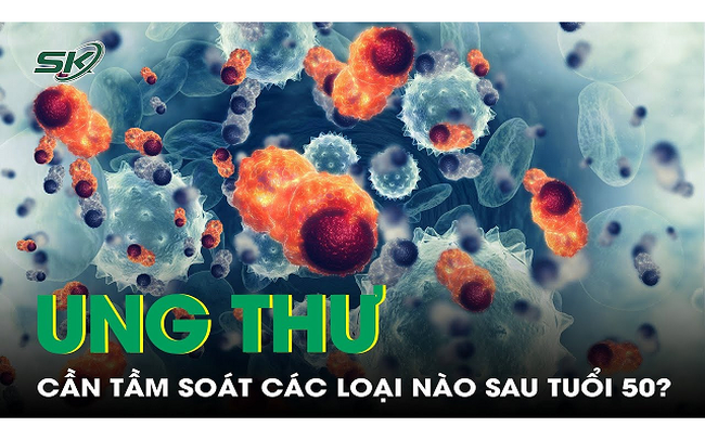 Từ 50 tuổi cần tầm soát các loại ung thư nào?