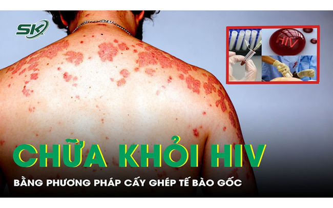 Người thứ 7 trên thế giới được chữa HIV nhờ liệu pháp tế bào gốc