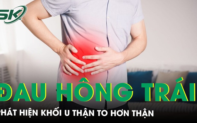 Đau vùng hông trái phát hiện khối u thận to hơn thận