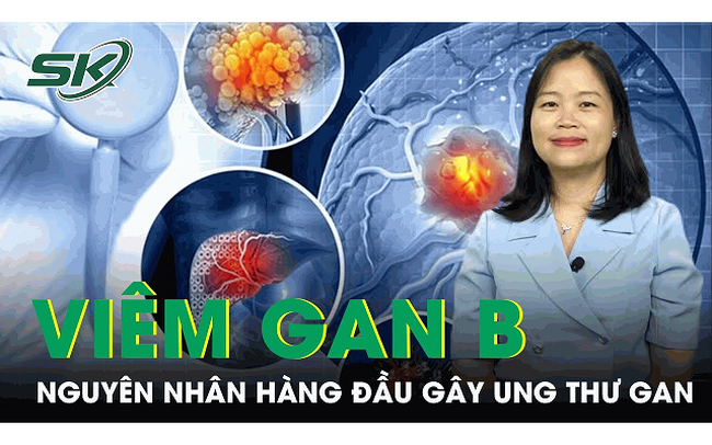 Viêm gan B: Nguyên nhân hàng đầu gây ung thư gan