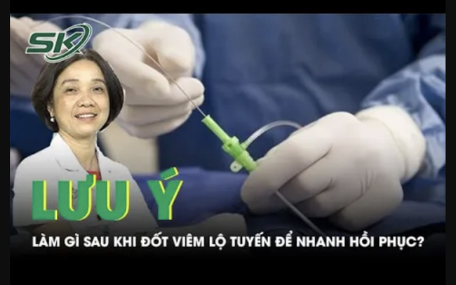 Những lưu ý sau khi đốt viêm lộ tuyến để nhanh hồi phục