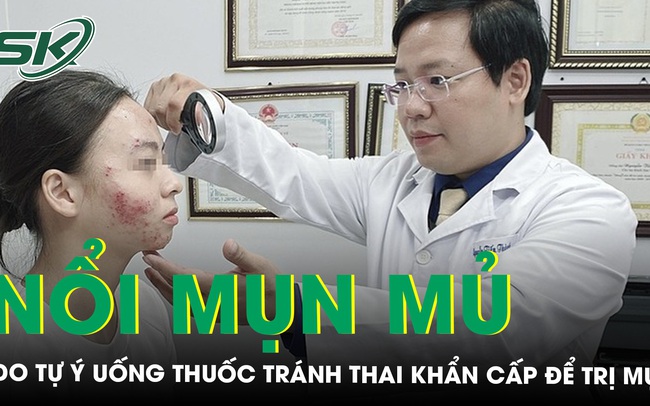 Da mẩn đỏ, nóng rát, nổi mụn mủ do tự ý uống thuốc tránh thai khẩn cấp để trị mụn