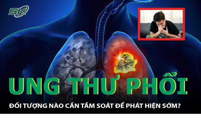 6 thói quen giúp nâng cao sức khỏe cho người đang điều trị ung thư phổi