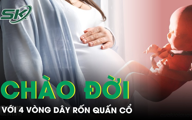 Bé trai chào đời với 4 vòng dây rốn quấn cổ