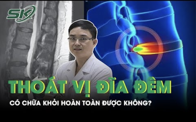 Thoát vị đĩa đệm có thể chữa khỏi dứt điểm không?