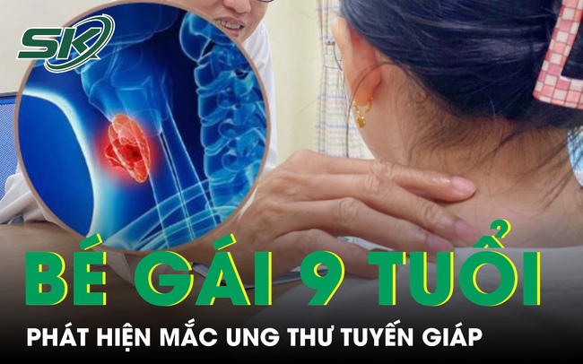 Bé gái 9 tuổi xuất hiện u ở cổ, đi khám phát hiện mắc ung thư tuyến giáp