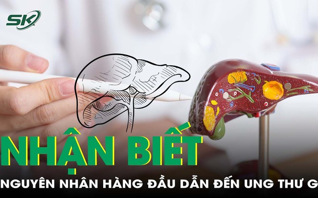 Nhận biết căn bệnh là nguyên nhân hàng đầu dẫn đến ung thư gan