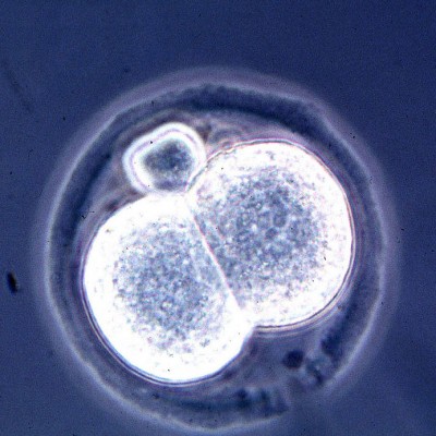 Các nhà khoa học phát triển hình ảnh thời gian thực của việc phát triển Embryos sử dụng quả trứng Quail