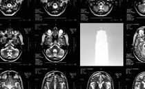 The Science Behind Ozempic Was Wrong