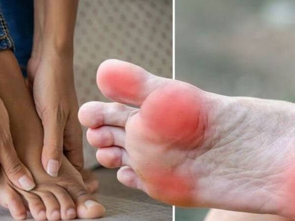 Vitamin B12 Deficiency Symptoms In 30s Women: 7 Warning Signs of Vitamin B12 Deficiency On Legs And Feet