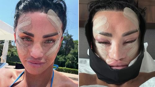 'Hãy công nhận: Katie Price tiết lộ hành trình nâng mặt 10k bị sốc từ đầu đến cuối trong video đồ họa