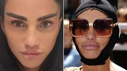 'Trong vòng 10 năm, bạn!': Katie Price cho thấy kết quả của việc nâng người mới nhất sau khi đi mua sắm váy cưới