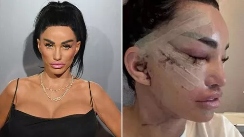 Không có gì. Katie Price đang lên kế hoạch phẫu thuật nhiều hơn cho Giáng sinh... khi Kerry Katona bước vào để giúp