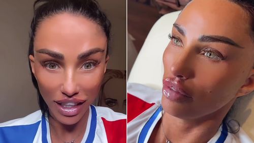 Katie Price còn được tiêm thêm môi và bộc lộ sự nhăn nhó lớn nhất của cô ấy