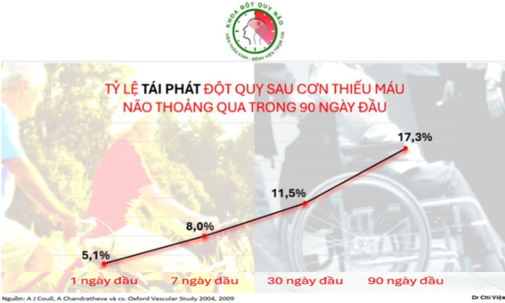 Cảnh báo đột quỵ từ cơn thiếu máu não thoáng qua