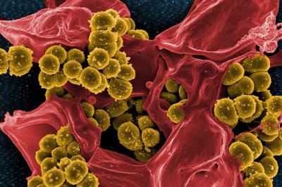 Researchers discover new class of drugs to fight antibiotic resistance