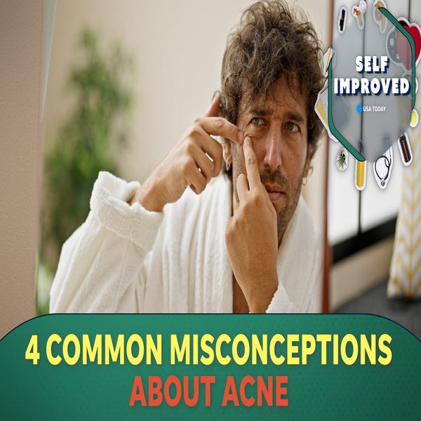 Quan niệm sai phổ biến nhất về acne