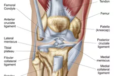 Biểu đồ vị trí đau đầu gối và nguyên nhân có thể gây ra