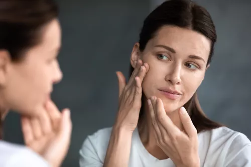 Biết gì về PCOS Acne