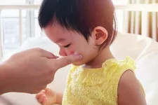 Cách điều trị Toddler Eczema