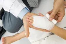 Đốt Blisters: Làm gì và không nên làm gì