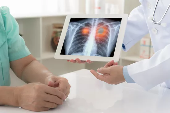 What Should I Know About KRAS-Positive Lung Cancer?