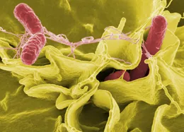 What Is Salmonella Septicemia?