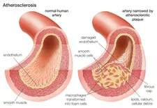 Xem toàn cảnh con nhện hóa dầu