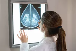 How Triple-Negative Breast Cancer Is Diagnosed