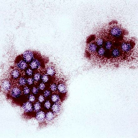 Norovirus: What To Know About The Illness That May Have Shuttered An Alabama School