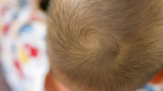 Có bánh Cowlick không? Làm tóc không nhất thiết là không thể