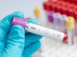 HIV chống AIDS: Có gì khác nhau?