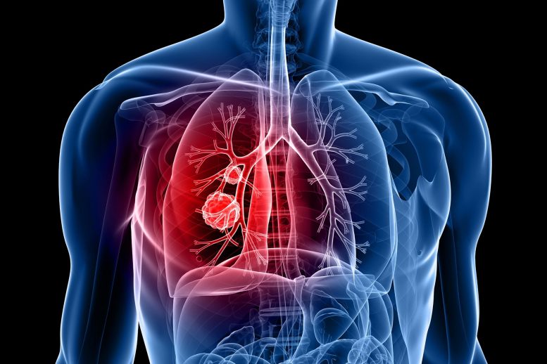 The Trojan Horse Approach – New Method Could Revolutionize Lung Cancer Treatment