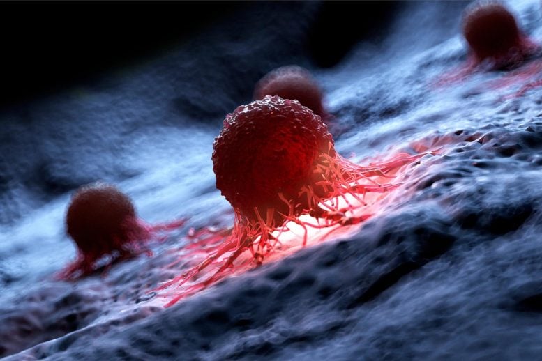 Scientists Discover Method To Stop Active Cancer Cells in Their Tracks