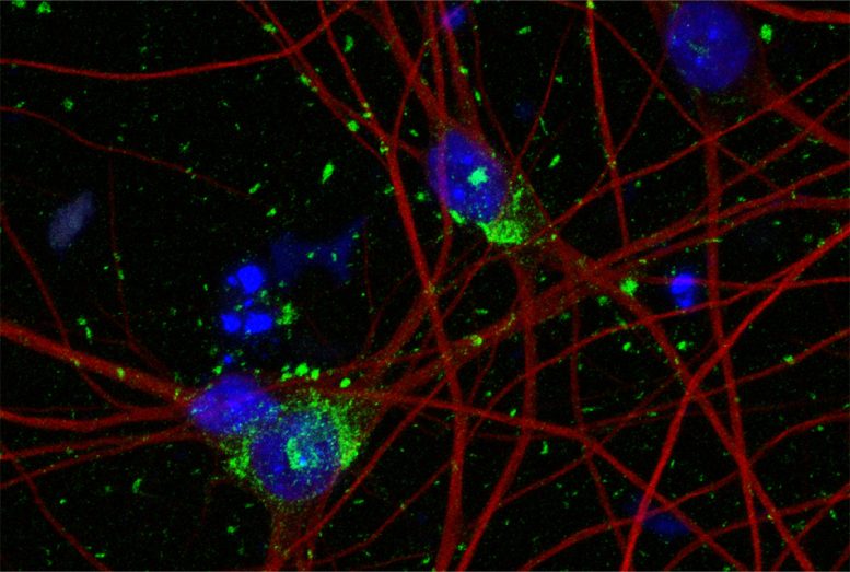 Cách mạng hóa cuộc nghiên cứu bệnh Alzheimer: Các nhà khoa học nghiên cứu về bệnh tiểu đường đã phát triển mô hình thần kinh đột phá