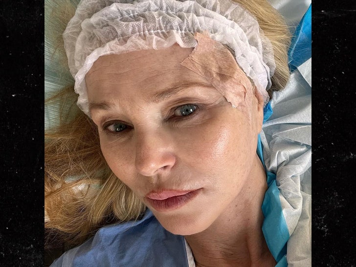 CHRISTIE BRINKLEY REVEALS SKIN CANCER DIAGNOSIS ... Shares Surgery Photos