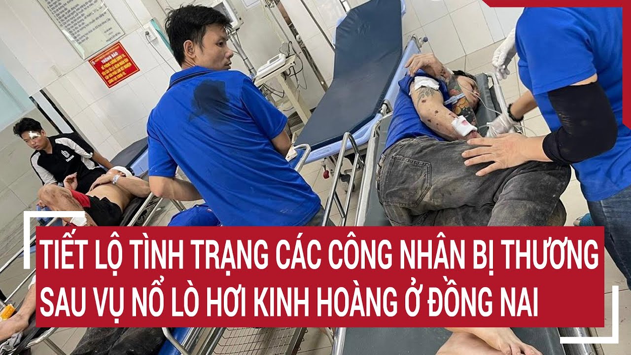 Tiết lộ tình trạng các công nhân bị thương sau vụ nổ lò hơi kinh hoàng ở Đồng Nai