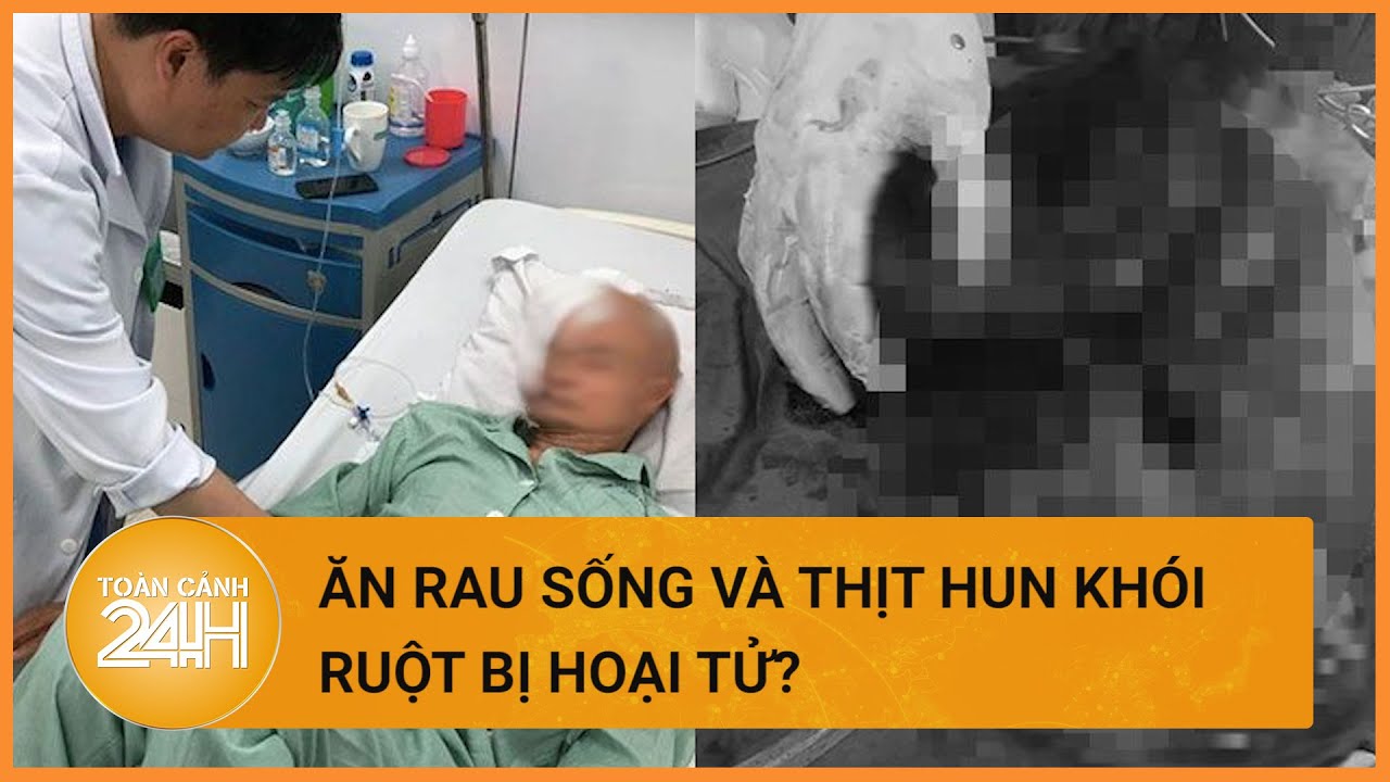 Ruột hoại tử sau khi ăn rau sống và thịt lợn hun khói| Toàn cảnh 24h