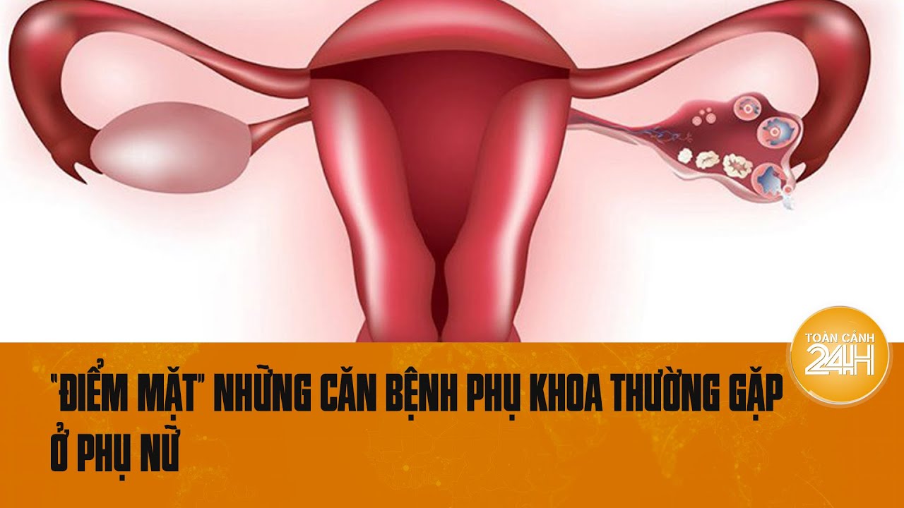 “Điểm mặt” những căn bệnh phụ khoa thường gặp ở phụ nữ | Toàn cảnh 24h