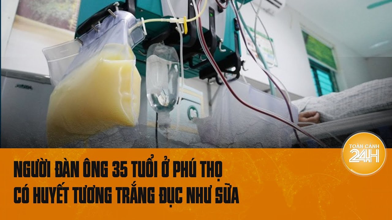 Người đàn ông 35 tuổi ở Phú Thọ có huyết tương trắng đục như sữa | Toàn cảnh 24h