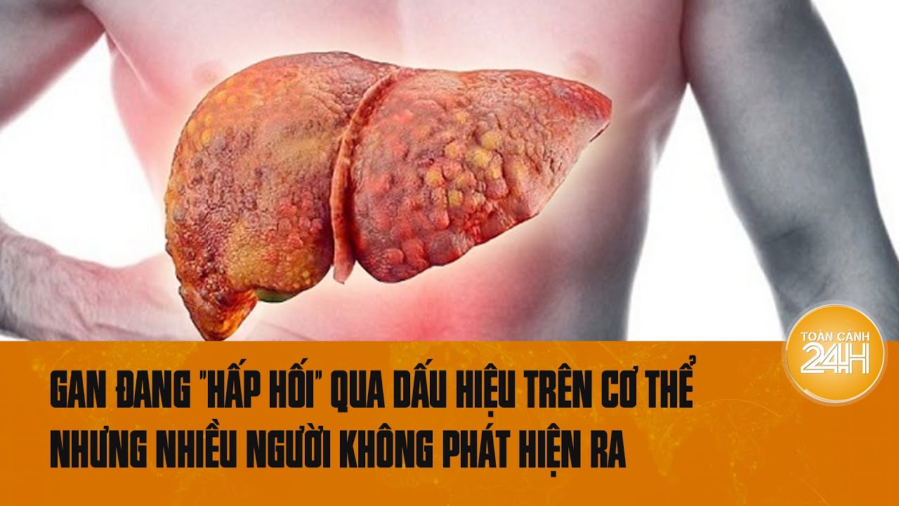 Gan đang "hấp hối" qua dấu hiệu trên cơ thể nhưng nhiều người không phát hiện ra | Toàn cảnh 24h